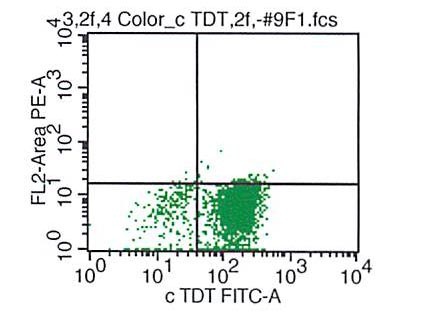 TdT
